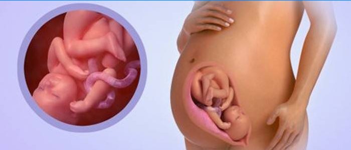 Plod po 36 týdnech těhotenství