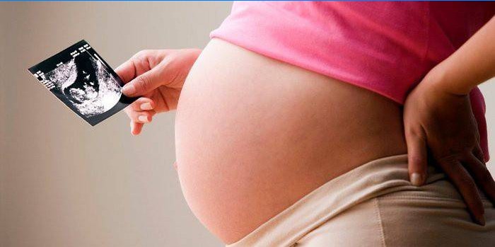 Těhotná žena po ultrazvuku