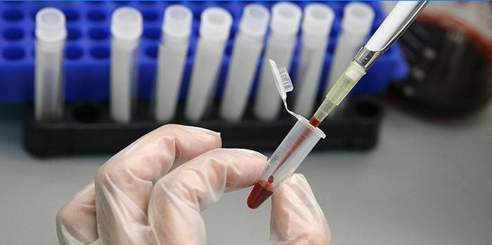 Medic provádí krevní test