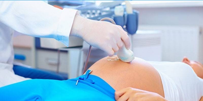 Ultrazvuk během těhotenství