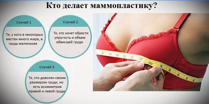 Indikace pro mamoplastiku
